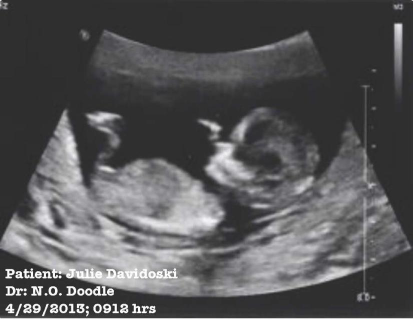 Don's caption? "Awesome...SOOOOOO excited for you guys!!"