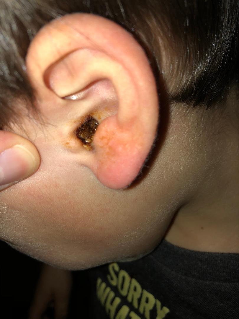 Robin-son-raisin-in-ear